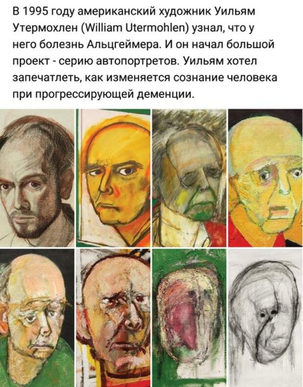 Порция убойных шуток о болезни Альцгеймера