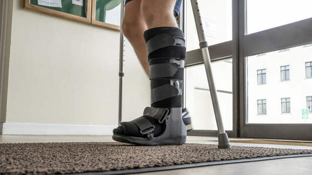 Врач: тяжёлые переломы более вероятны у людей с избыточной массой тела