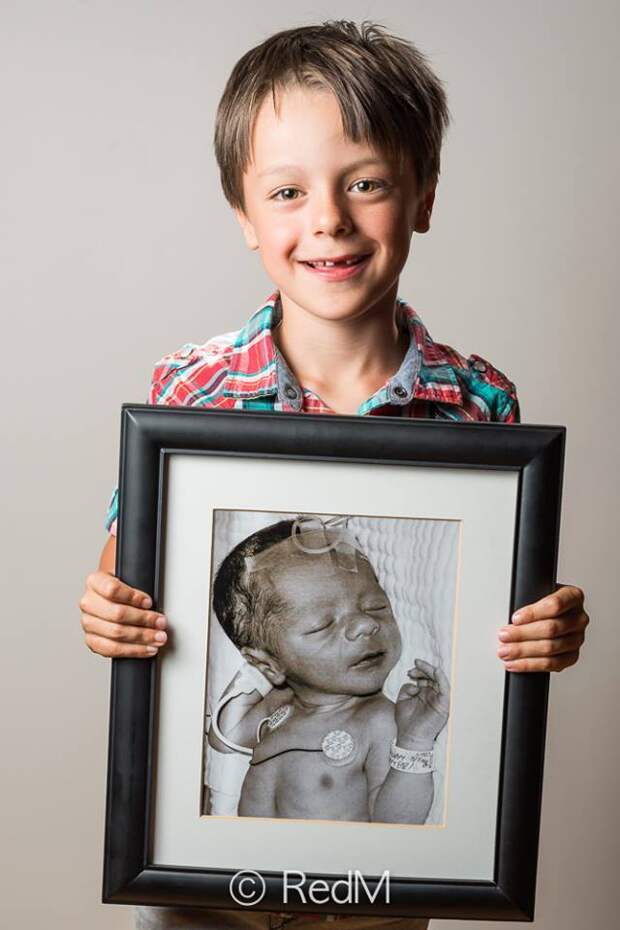 Вдохновляющие портреты людей, которые родились недоношенными и выжили
