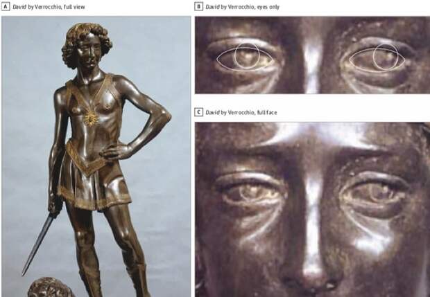 2. Скульптура «Давид». 1475 г.