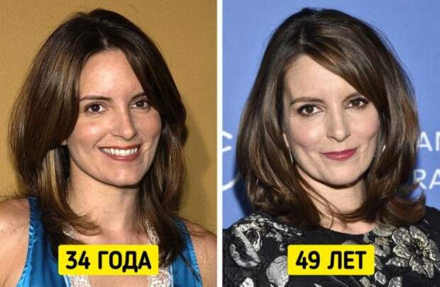 Знаменитые женщины, которые отказались от уколов красоты