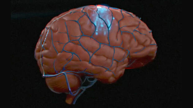 Человеку впервые имплантировали нейрокомпьютерный интерфейс