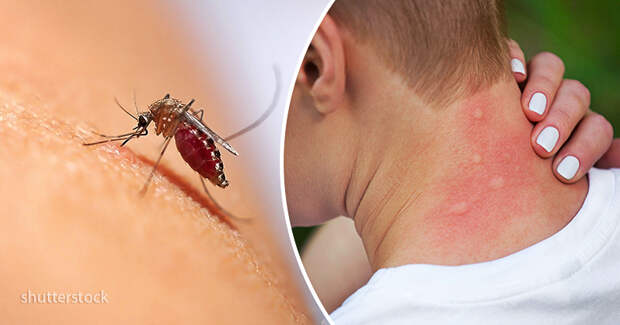 Самые элементарные натуральные способы избавиться от комаров. Гуд бай, надоедливые кровососы!