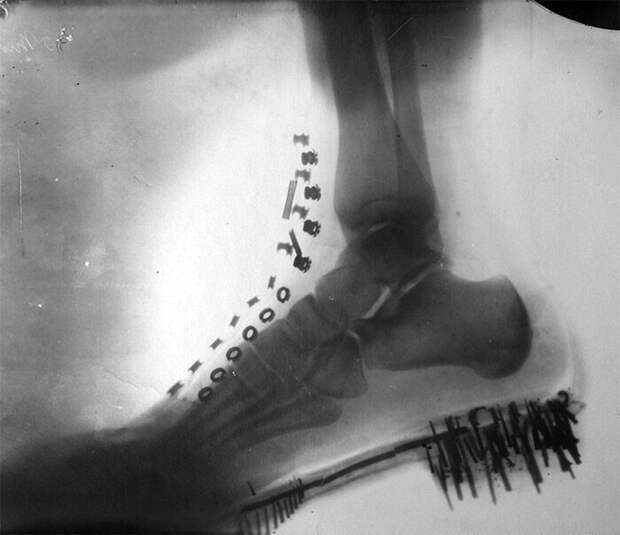 Нога Николы Теслы в ботинке: рентгеновский снимок, сделанный им самим на аппарате собственной конструкции в 1896 году