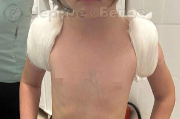 В Магнитогорске девочка сломала ключицу на тюбинговой трассе