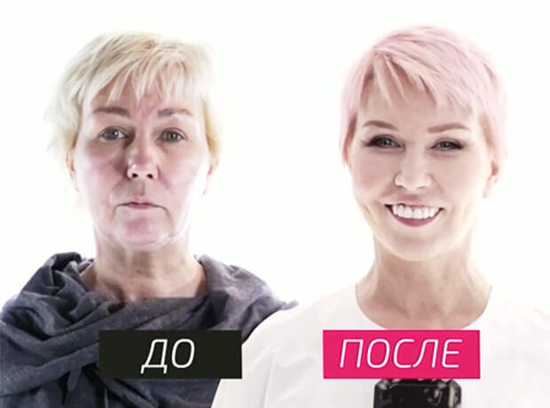Изменения налицо: российские телеведущие до и после пластики