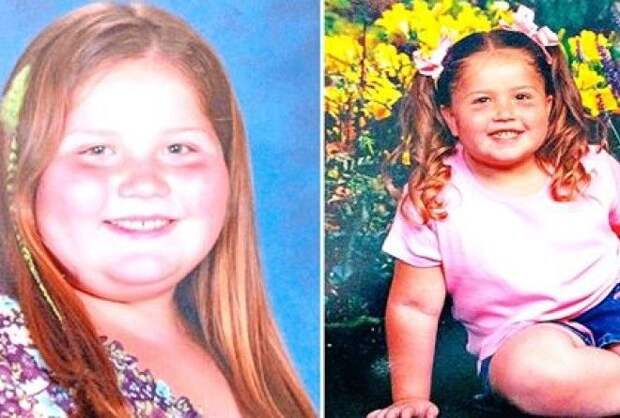 Все дети в классе травили эту 9-летнюю девочку из-за её огромного веса.