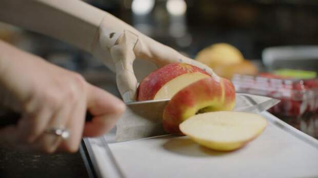 prosthetic arm 3d printed