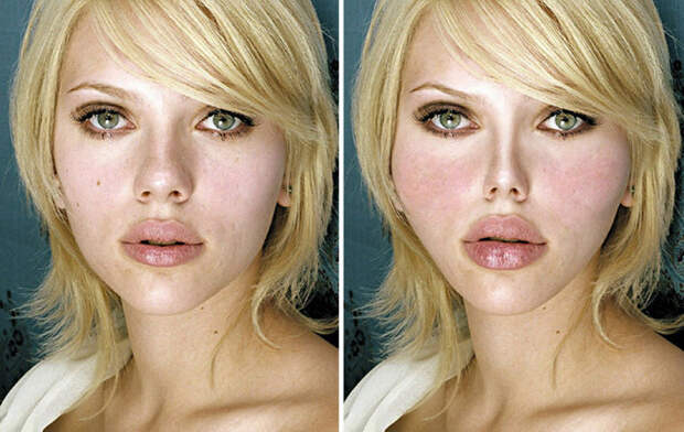 Так изменилось бы лицо известной американской актрисы Скарлетт Йоханссон (Scarlett Johansson), если бы над ее внешностью поработал пластический хирург.
