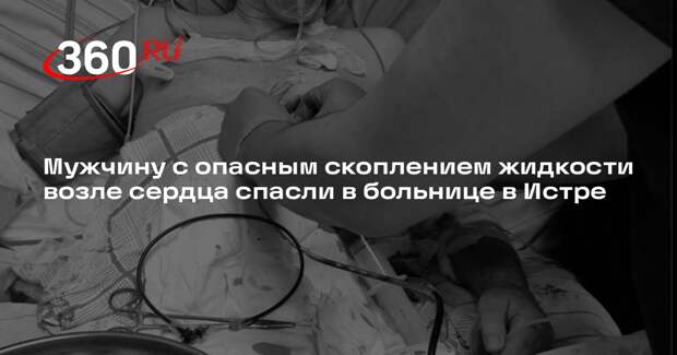 Мужчину с опасным скоплением жидкости возле сердца спасли в больнице в Истре