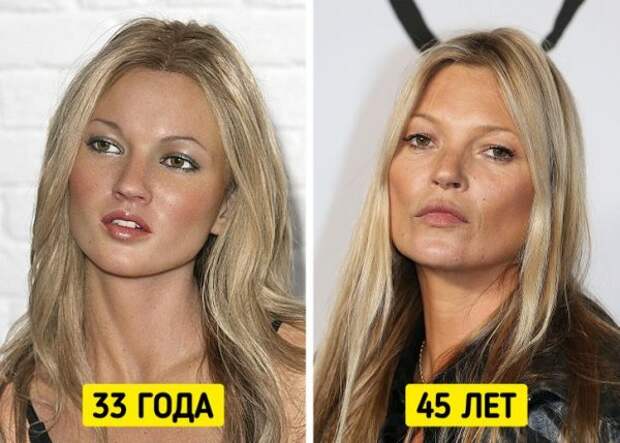 Знаменитые женщины, которые отказались от уколов красоты