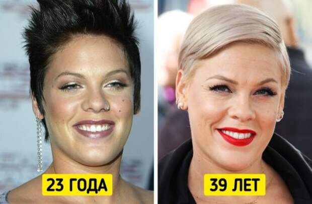 Знаменитые женщины, которые отказались от уколов красоты