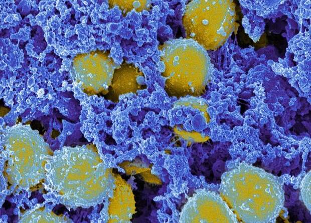 Антимикробные пептиды из тканей человека помогут в лечении инфекций