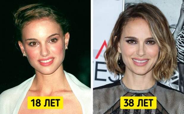 Знаменитые женщины, которые отказались от уколов красоты