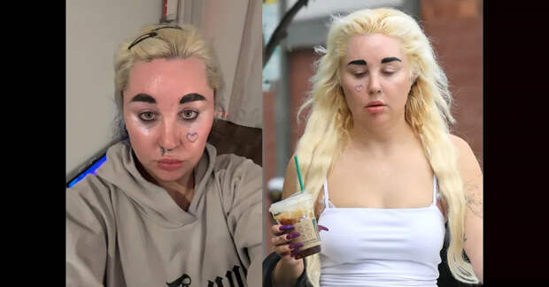 В сети появились снимки сильно похудевшей Аманды Байнс после приёма "Оземпика"