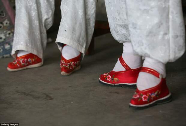 В деревне «Связанные ноги» живут последние китаянки, страдающие от древней жестокой традиции