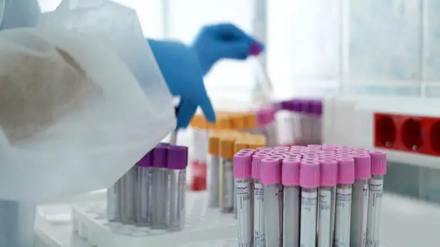 Собянин прокомментировал ситуацию с коронавирусом в Москве