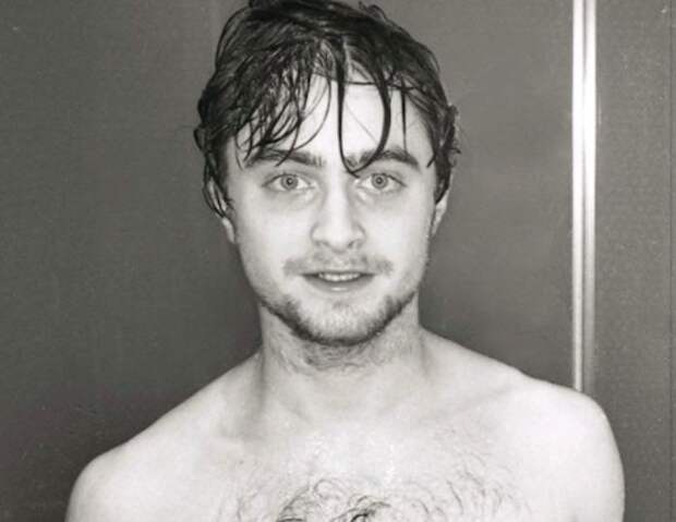 Гарри Поттер уже не тот: 28-летний Дэниел Рэдклифф выглядит болезненно