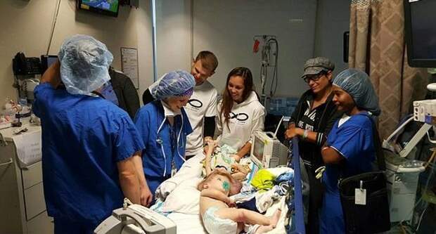 В США успешно разделили близнецов-краниопагов дети, операция, сша