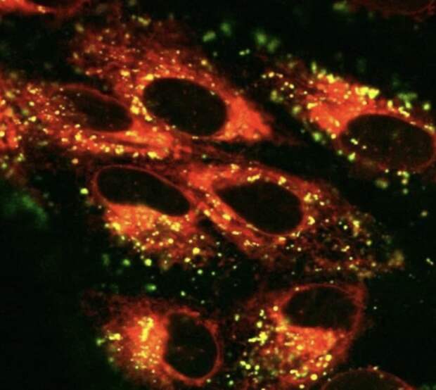Разрушение сетчатки смогут выявлять с помощью лазерной спектроскопии