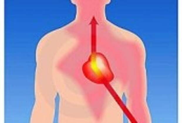 Жжение в грудной клетке слева. Angina pectoris – anguish. Значок грудной Жабы стенокардия. Болезнь тургенева грудная жаба