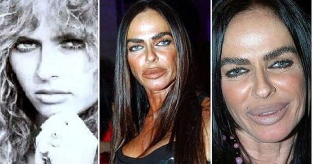 SB6 бывших красоток которые изуродовали себя пластикой