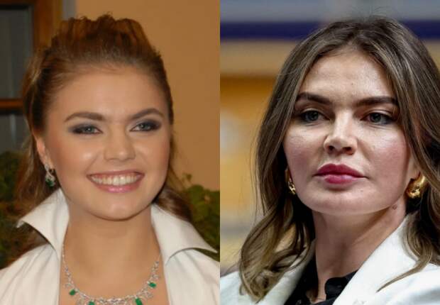 «Она не ела почти ничего неделями»: как Алина Кабаева добилась всего, но скрывает самое главное