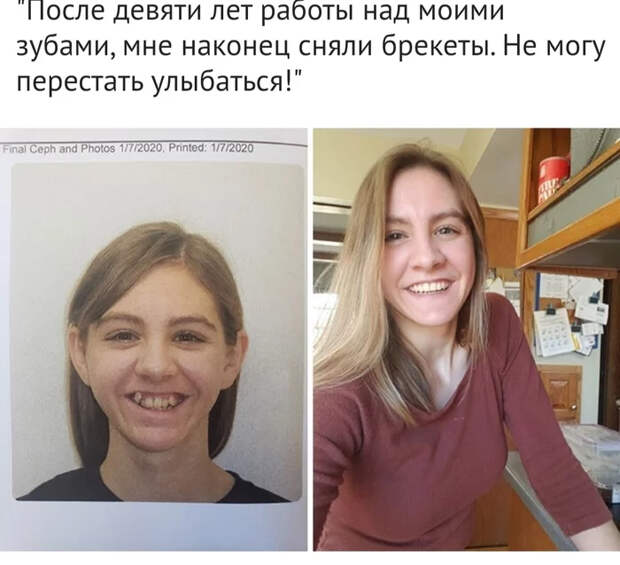 Занимательные фото-сравнения, которые открывают новый взгляд на мир Сравнение, Было-Стало, Фотография, Жизнь, Прошлое, Настоящее, Интересное, Длиннопост