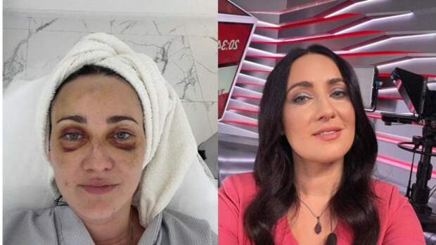 Соломия Витвицкая покзала, как фото до и после макияжа