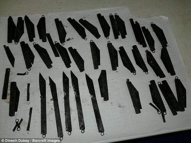 Индиец проглотил 40 ножей, потому что ему понравился их вкус больные люди, индия, ножи, операция