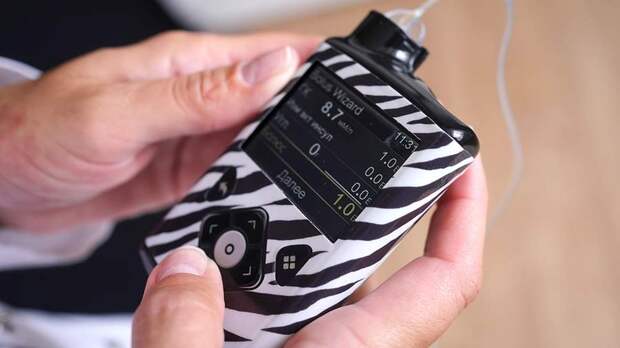 Врачи перечислили симптомы диабета у ребенка