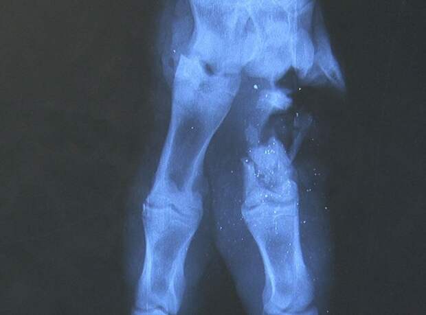 Рентгеновский снимок повреждения. 