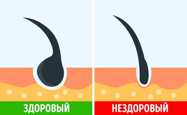 Как проверить, все ли в порядке с волосами, и как грамотно за ними ухаживать