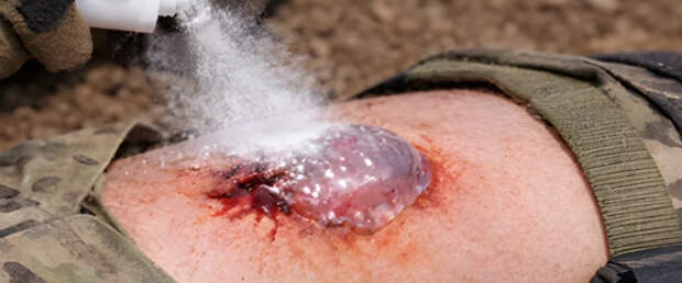 Новый спрей останавливает кровотечение из раны за секунду