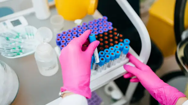 Инфекционист Тимаков прокомментировал отрицательные ПЦР-тесты у инфицированных COVID-19