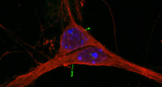 nerve cell cilia