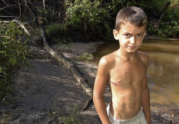 Матеус Перейра де Арахо на фоне пятиметровой анаконды, которая чуть не убила его день назад, когда он играл возле речки неподалёку от фермы своего деда.  животные, люди