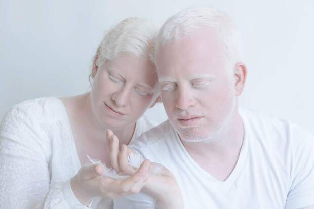Ярон и Тслил альбиносы, красота, люди, фото, фотограф, фотопроект, цвет кожи