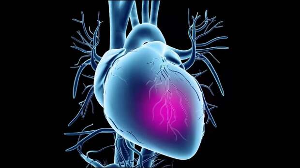 Внезапная остановка сердца - факторы риска и предвестники