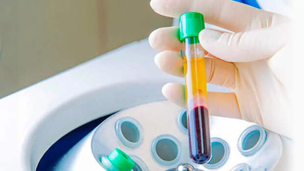 Плазмолифтинг или гиалуроновая кислота для колена: что лучше? Отзывы и сравнение