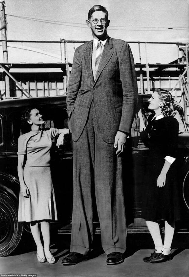 Роберт часто позировал для фотографий с людьми, которые его об этом просили. Ему дали прозвище "Небоскреб" акромегалия, великан, опухоль, рекорд, рекорд гиннесса, рекордсмен Гинесса, самый высокий, самый высокий человек