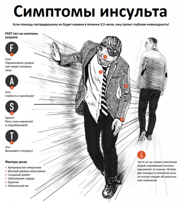 Первые симптомы инсульта и 7 мер экстренной доврачебной помощи Первые симптомы инсульта и 7 мер экстренной доврачебной помощи