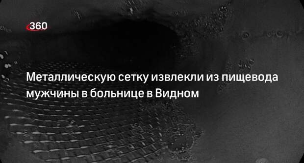 Металлическую сетку извлекли из пищевода мужчины в больнице в Видном