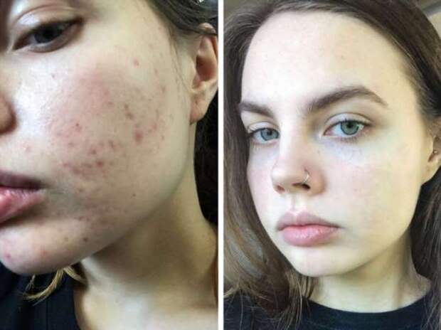 15+ девушек до и после нанесения естественного макияжа