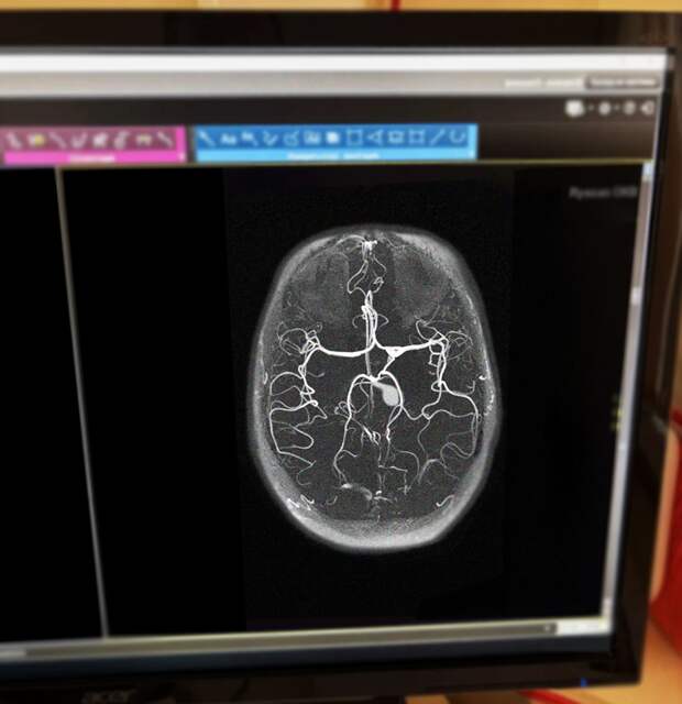 Рязанца смогли доставить в больницу в «золотой час» благодаря бдительному соседу