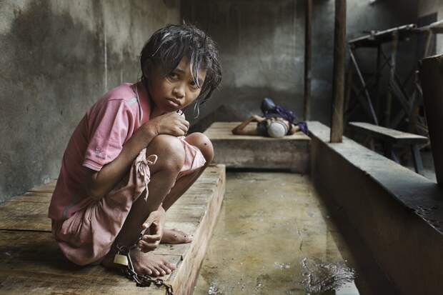 Низшая форма жизни: ужасающие условия индонезийских лечебниц для душевнобольных