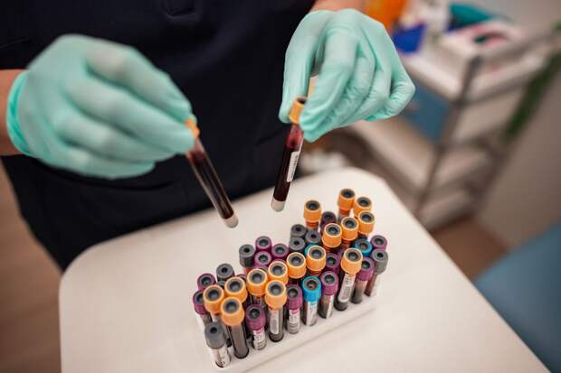 Оспу обезьян подтвердили одному из двоих пациентов в больнице в Подмосковье