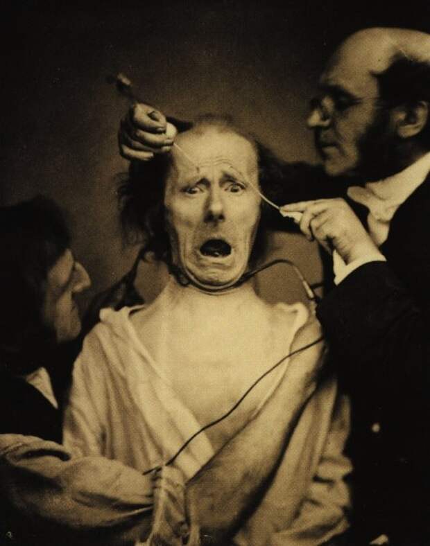 Леденящие душу старинные фотографии экспериментов по неврологии (25 фото)