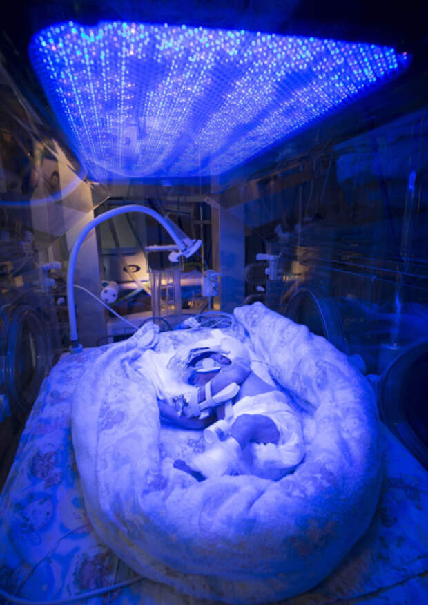 Победители конкурса фотографии в области биомедицины Wellcome Image Awards 2016