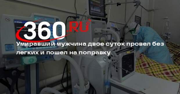 Умиравший мужчина двое суток провел без легких и пошел на поправку